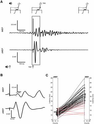 Ipsilateral Motor Evoked Potentials as a Measure of the Reticulospinal Tract in Age-Related Strength Changes